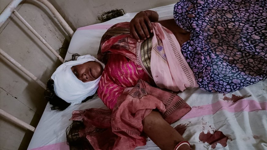 गुना: दंपति पर जानलेवा हमला कर सिर पर लाठी मारकर किया घायल
