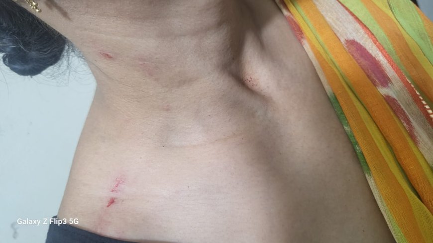 चेन खींचने वाले बाइकर्स गैंग से भिड़ गई महिला, लूट की कोशिश पर फेरा पानी