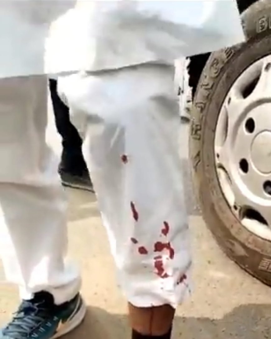 भाजपा प्रत्याशी पर जानलेवा हमले की रक्तरंजित तस्वीर