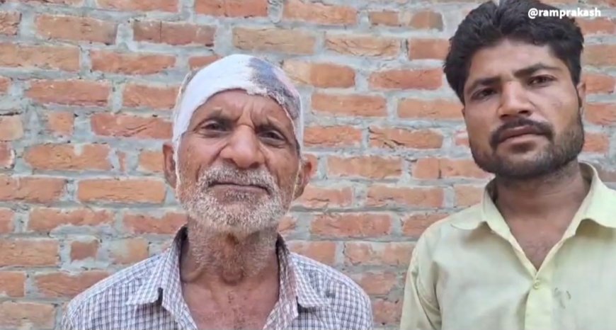शाहाबाद: खेत में पानी लगाने को लेकर विवाद, दबंगों ने ग्रामीण को पीटकर लहूलुहान किया