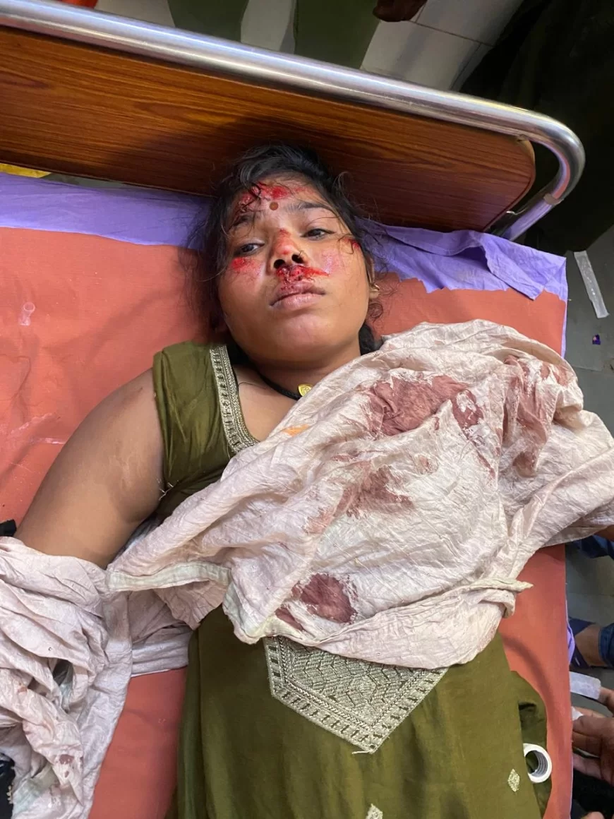 चाचा द्वारा बटाईदार को भला बुरा कहने का भतीजे ने किया विरोध, गुस्साये चाचा ने भतीजे व भतीजी को पीटकर किया लहुलुहान