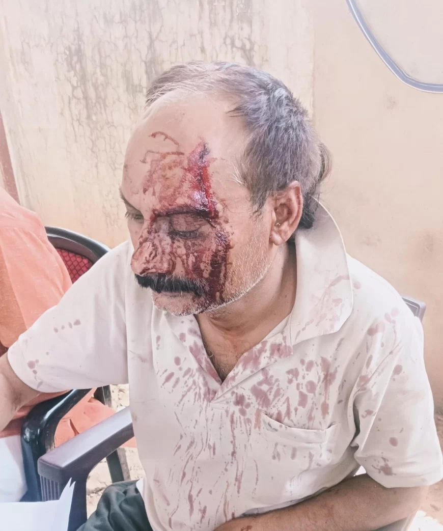 पत्रकार पर जानलेवा हमले मामले मे केस दर्ज, शिव मंदिर के आसपास मिट्टी डालने के दौरान रोकने पहुंची महिलाओं ने किया था जानलेवा हमला